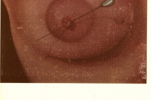 1)Catalogo